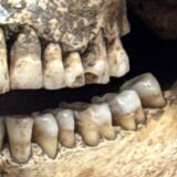 歯はやっぱり大事！