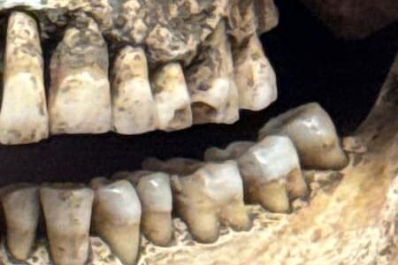 歯はやっぱり大事！